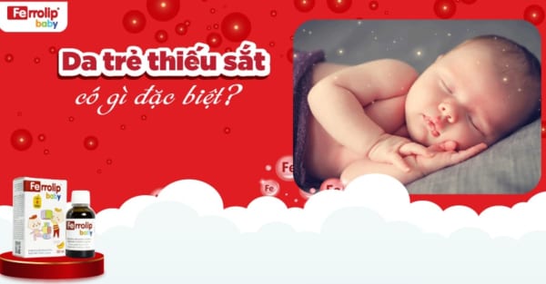 Da trẻ thiếu sắt có gì đặc biệt? Làm sao biết trẻ thiếu sắt?