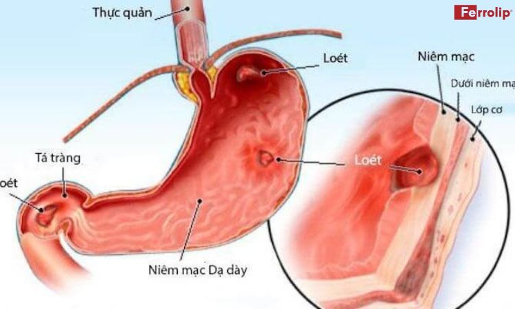 bầu không nên uống sắt buổi tối