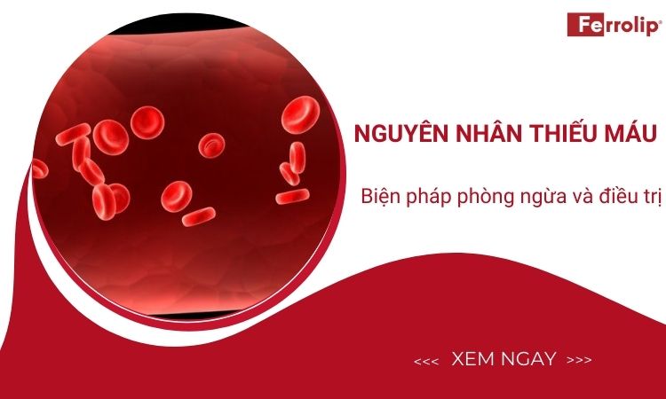 Nguyên nhân thiếu máu - Biện pháp phòng ngừa và điều trị
