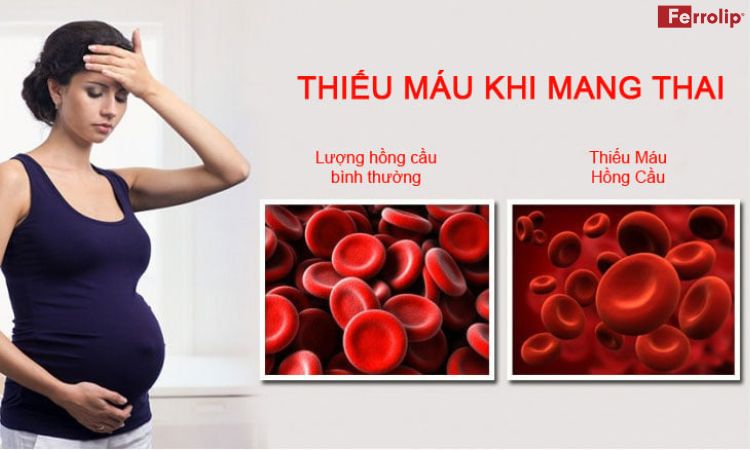 thiếu m&aacute;u 3 th&aacute;ng cuối